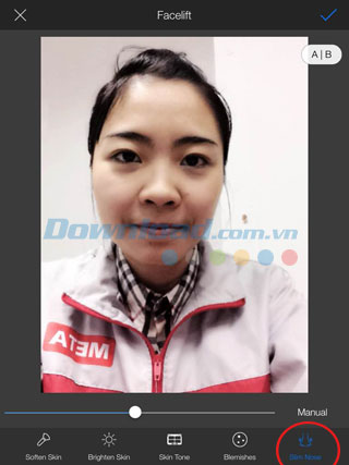 Làm thon gọn mũi