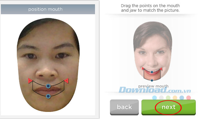 Sửa môi Sửa môi