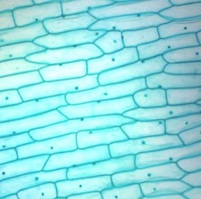 Tế bào biểu bì vảy hành