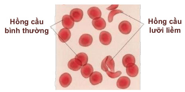 Hồng cầu