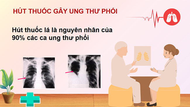 PowerPoint về phòng, chống tác hại của thuốc lá
